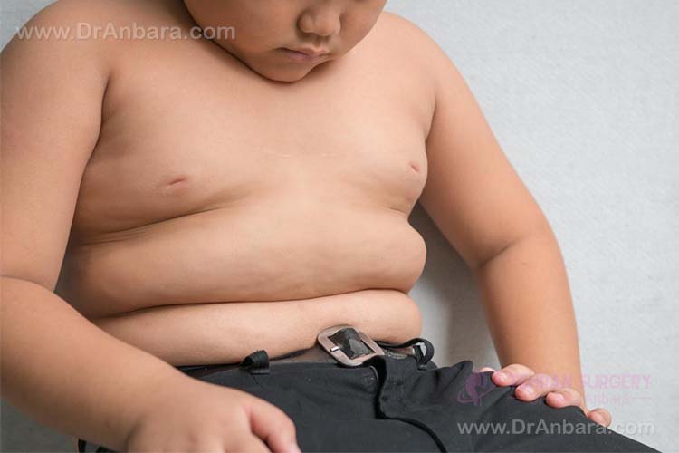 چه چیزی باعث چاقی در کودکان می شود؟