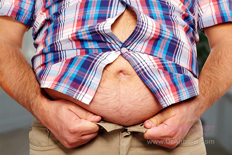 اسلیو معده بهتر است یا بای پس معده ؟ اسلیو معده بهتر است یا بای پس معده ؟