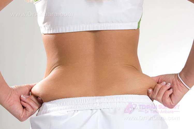 چگونه از شر چربی های شکم و پهلو خلاص شویم؟ چگونه از شر چربی های شکم و پهلو خلاص شویم؟