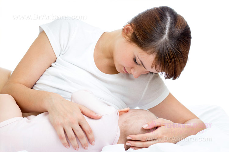 بارداری پس از عمل اسلیو معده
