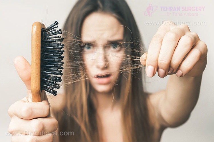 ریزش مو بعد از جراحی اسلیو معده