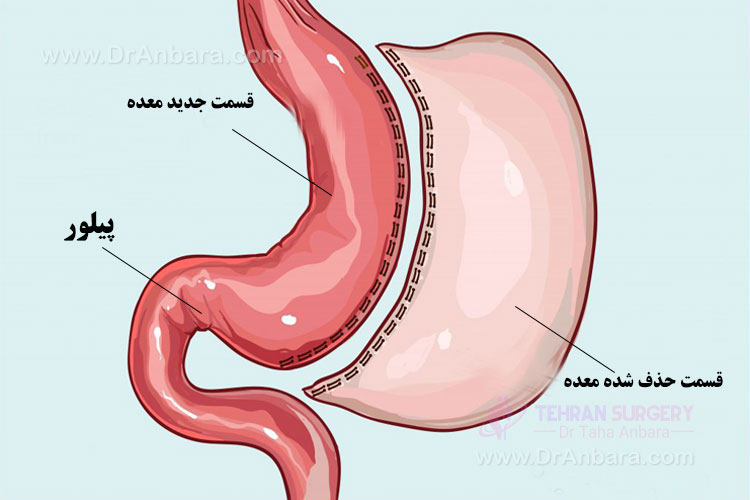 عمل اسلیو