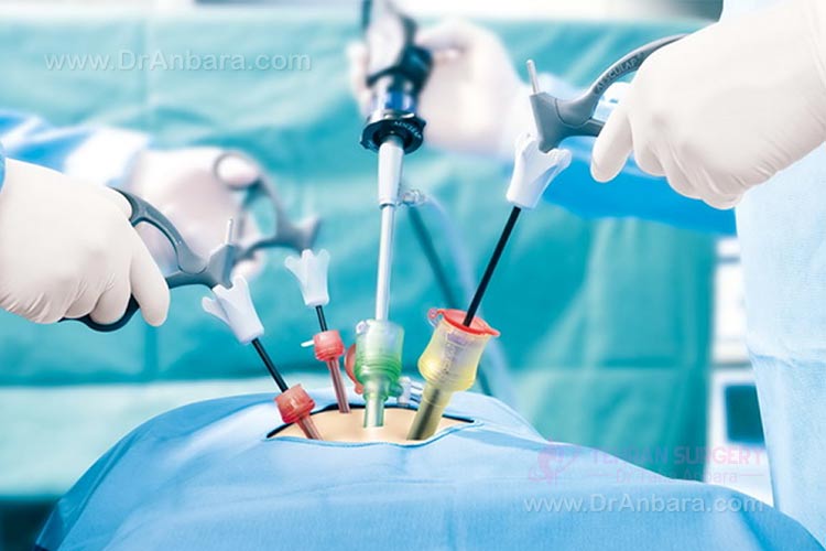 جراحی لاپاراسکوپی