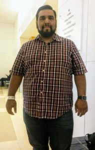 دنیل قبل از جراحی لاغری