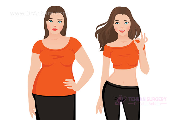 کاهش وزن پس از جراحی لاغری