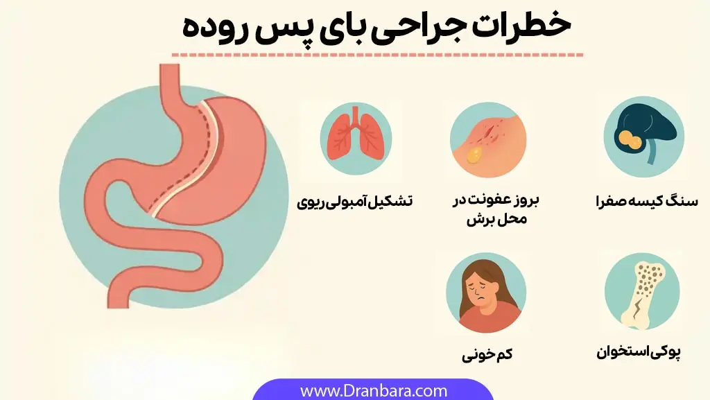 خطرات جراحی بای پس روده