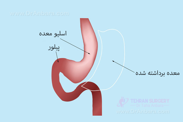 نقش معده در گوارش غذا