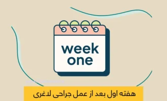 هفته اول بعد از عمل لاغری شاخص