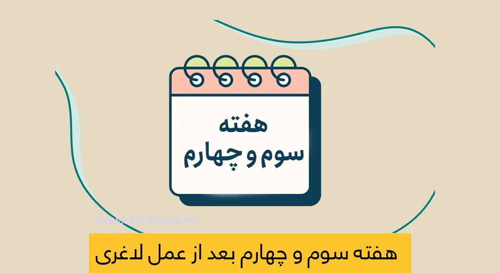 هفته سوم و چهارم بعد از عمل لاغری