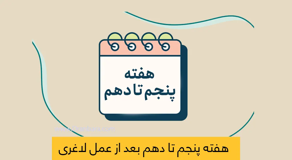 هفته پنجم تا دهم بعد از عمل لاغری شاخص