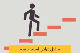 مراحل اسلیو معده