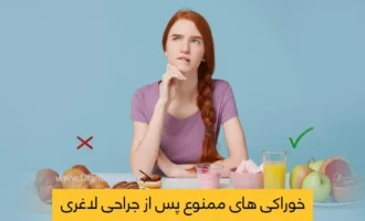 خوراکی های ممنوع پس از جراحی لاغری