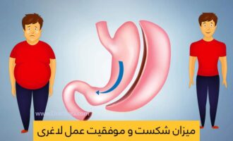 میزان موفقیت عمل لاغری