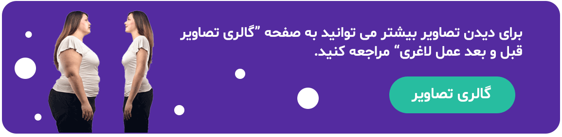 لینک دیدن عکس های قبل و بعد از افرادی که جراحی آستین انجام داده اند