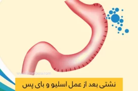 نشتی بعد از عمل اسیلو معده