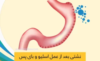 نشتی بعد از عمل اسیلو معده