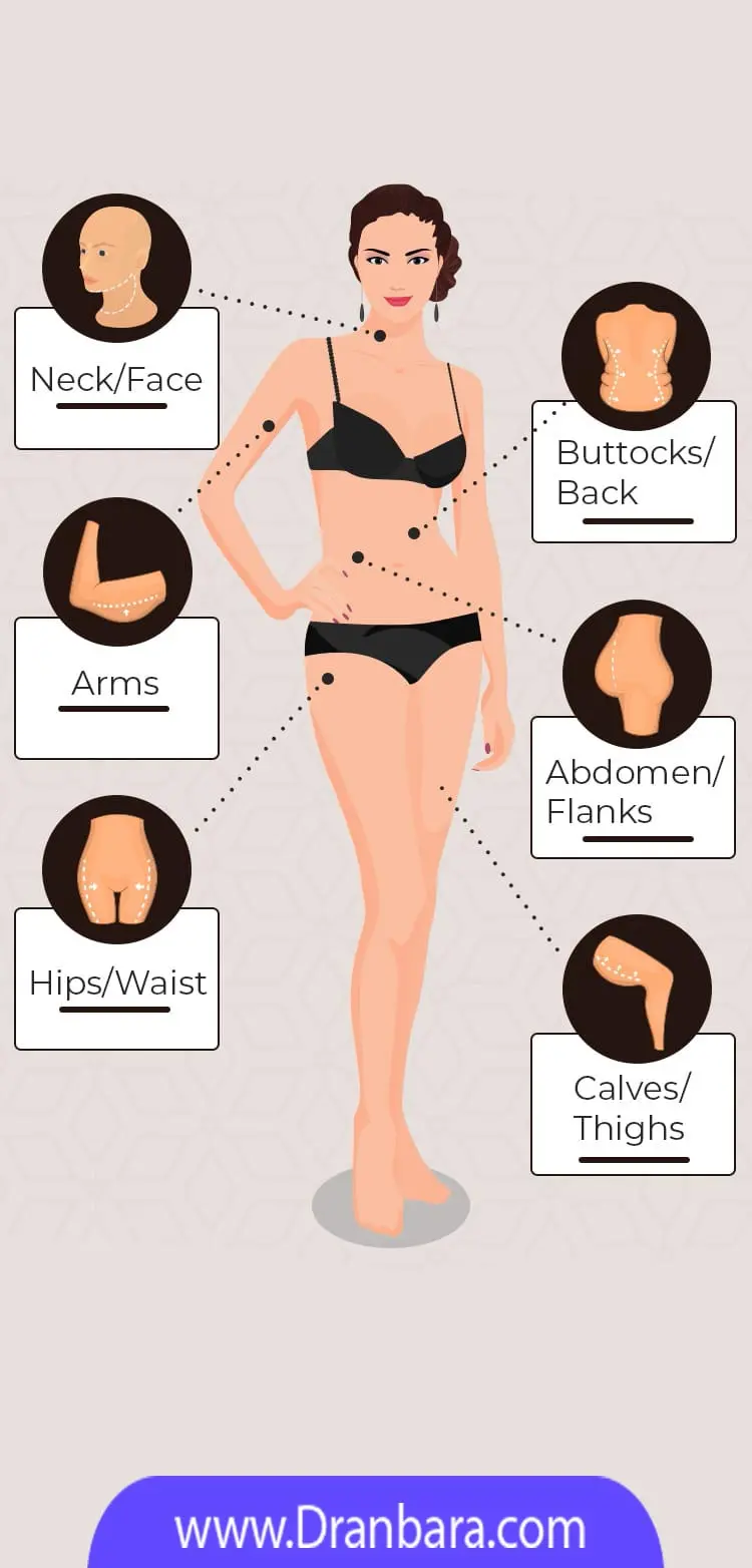 چه بخش هایی از بدن ساکشن می شوند