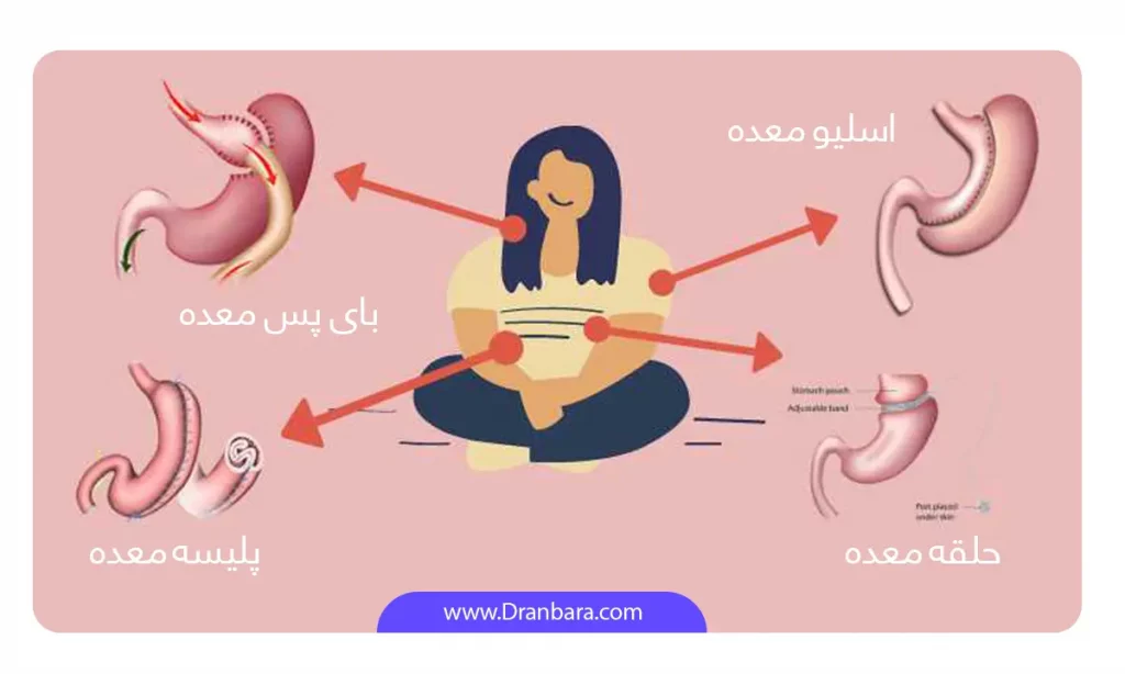 اینفوگرافی انواع عمل لاغری