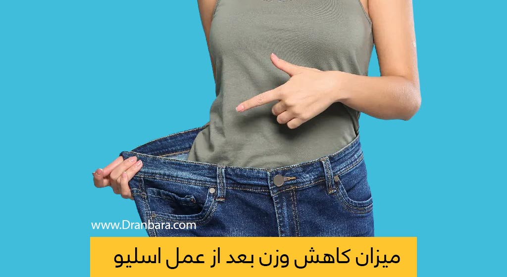 شاخص میزان کاهش وزن بعد از عمل اسلیو معده