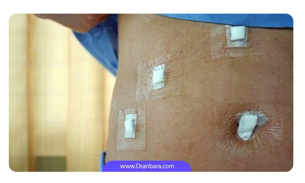 جای زخم بعد از عمل لاغری