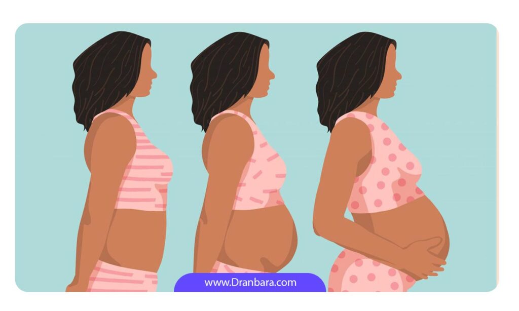 عکس شماتیک بارداری بعد از عمل اسلیو معده