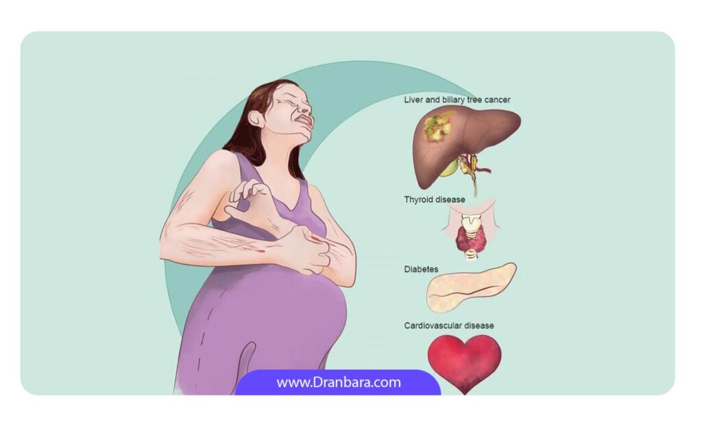 علائم کبد چرب در بارداری