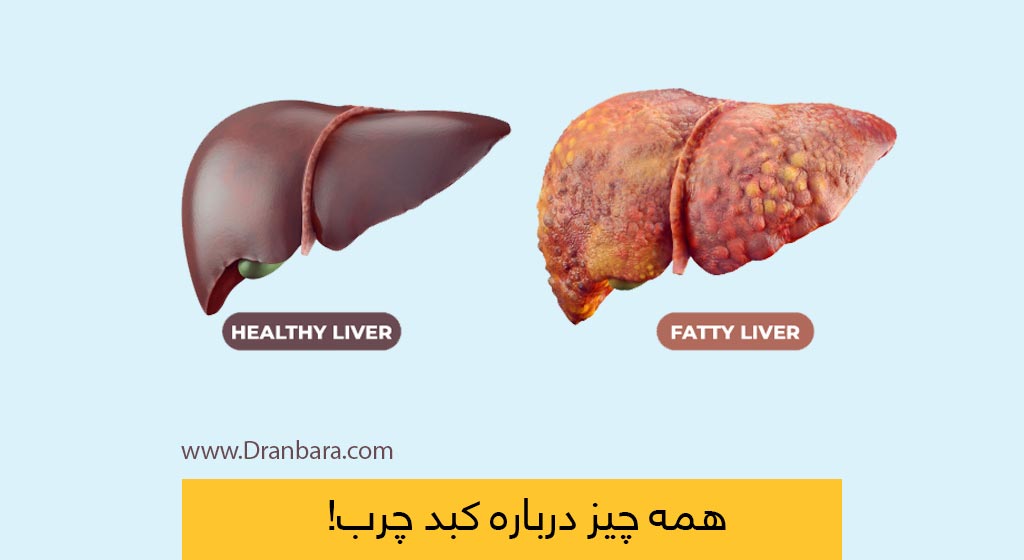 عکس کبد سالم و کبد چرب