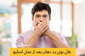 بوی بد دهان بعد از عمل اسلیو معده