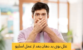 بوی بد دهان بعد از عمل اسلیو معده