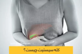 کله سیستیت شاخص