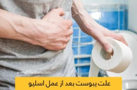یبوست بعد از عمل اسلیو معده