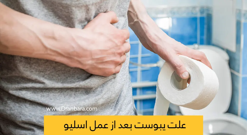 یبوست بعد از عمل اسلیو معده