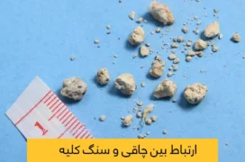 ارتباط بین چاقی و سنگ کلیه شاخص