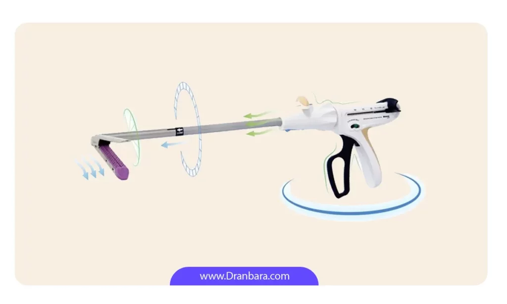 استاپلر معده