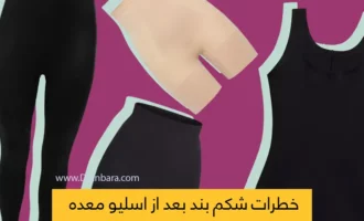 شکم بند بعد از عمل اسیلو معده