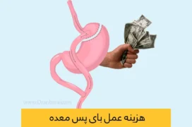 هزینه بای پس معده شاخص