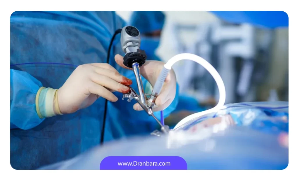 لاپاراسکوپی