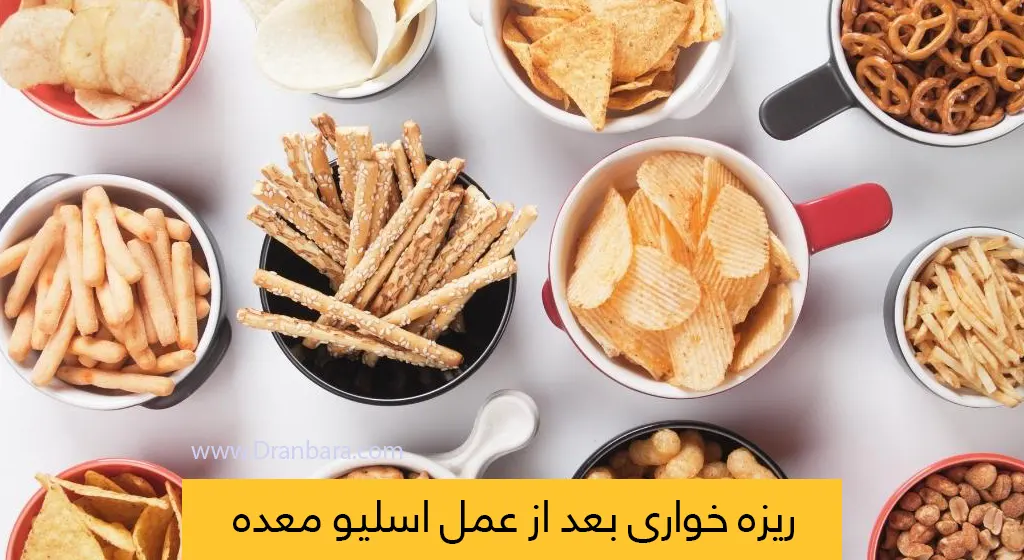 ریزه خواری بعد از عمل اسیلو معده شاخص