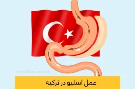 عمل اسلیو معده در ترکیه شاخص
