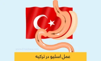 عمل اسلیو معده در ترکیه شاخص