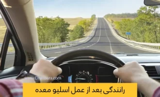 رانندگی بعد از عمل اسیلو معده شاخص