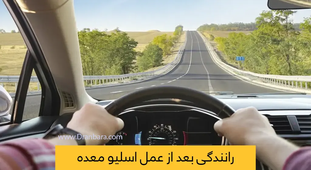 رانندگی بعد از عمل اسیلو معده شاخص
