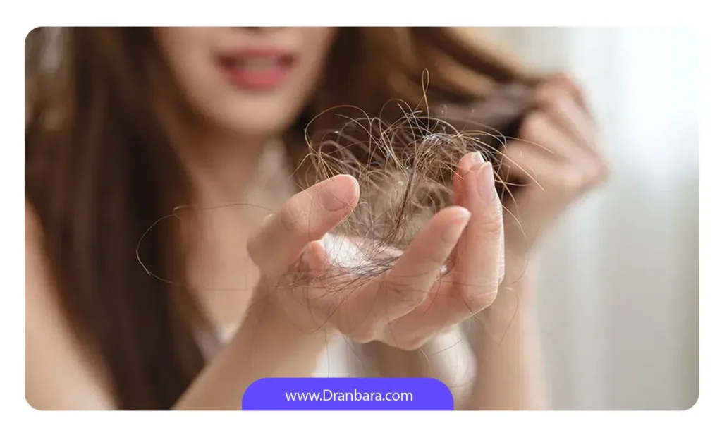 ریزش موی سر در دوره نقاهت بای پس معده